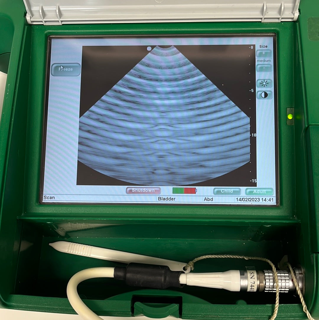 Bard Scan 2 Bladder scanner Bladder ultrasound